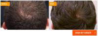 Follicle Rx Prices image 1